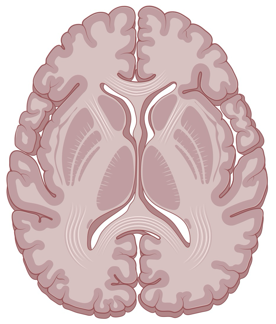 Axial brain slice showing approximate lobe positions