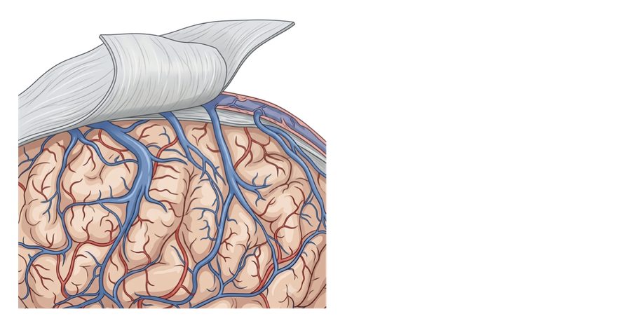 Diagram of the brain's surface beneath the dura, showing cortical bridging veins crossing the subdural space to drain into a dural venous sinus.